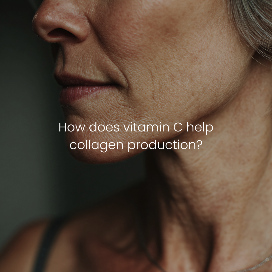 How does vitamin c help collagen production
