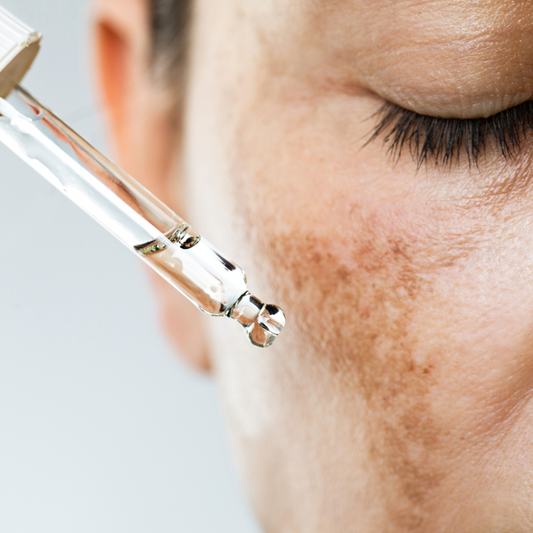 Understanding Skin Pigmentation and Aging: The Science and Prevention