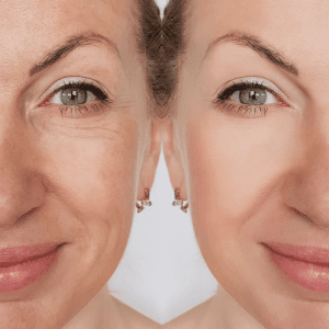 Naturally Brightening the Skin